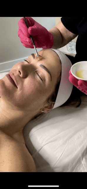 chemical peel smooth skin, anti-aging, skincare