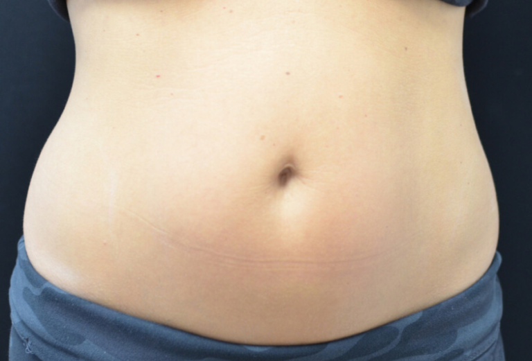 STOMACH-01