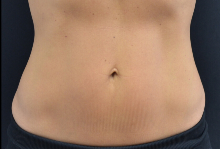 STOMACH-02
